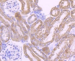 Cytochrome P450 17A1 Antibody (JB93-32), Novus Biologicals 100 &mu;L | Buy Online | Novus Biologicals | Fisher Scientific